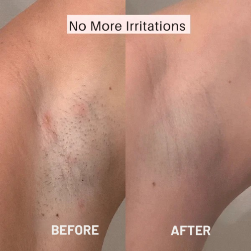 Dame barbermaskine – Glat hud uden irritation